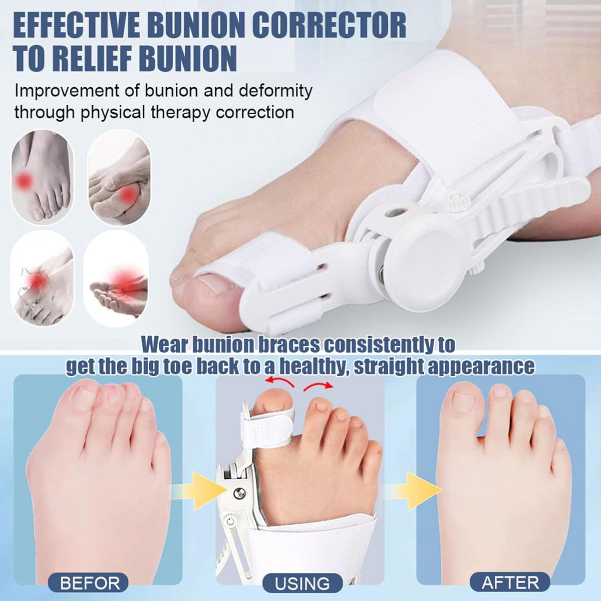Bunion Toe Corrector – Orthopedic Big Toe Straightener & Pain Relief Brace ⭐⭐⭐⭐⭐ (4.8/5) Ratings
